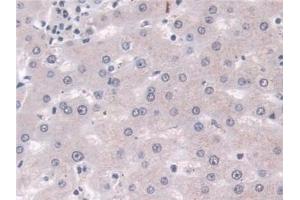 Detection of PLD in Human Liver Tissue using Polyclonal Antibody to Phospholipase D (PLD) (Phospholipase D 抗体  (AA 725-1074))