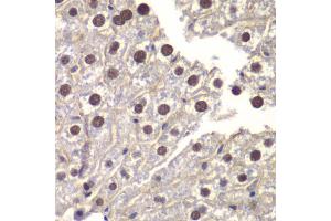 Immunohistochemistry of paraffin-embedded mouse liver using ST14 antibody (ABIN6293606) at dilution of 1:200 (40x lens). (ST14 抗体)