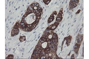 Image no. 6 for anti-Src-like-adaptor 2 (SLA2) antibody (ABIN1500949)