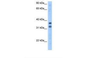 Image no. 1 for anti-Tripartite Motif Containing 13 (TRIM13) (AA 51-100) antibody (ABIN324386) (TRIM13 抗体  (AA 51-100))
