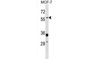 Western Blotting (WB) image for anti-Endogenous Retrovirus Group W, Member 1 (ERVW-1) antibody (ABIN2999163) (ERVW-1 抗体)