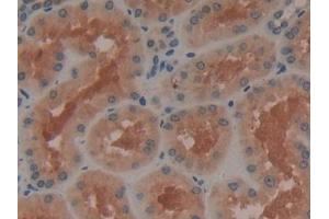 Immunohistochemistry (IHC) image for anti-Adenylate Cyclase 3 (ADCY3) (AA 501-736) antibody (ABIN7441868)