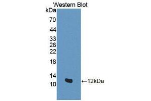 Western blot analysis of the recombinant protein. (GTF2H5 抗体  (AA 1-71))
