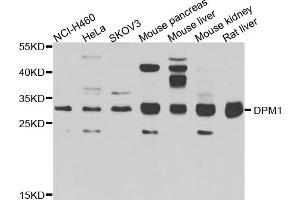 Western blot analysis of extracts of various cell lines, using DPM1 antibody (ABIN5975633) at 1/1000 dilution. (DPM1 抗体)