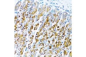 Immunohistochemistry of paraffin-embedded mouse stomach using C antibody (ABIN3021053, ABIN3021054, ABIN3021055 and ABIN6213930) at dilution of 1:100 (40x lens).