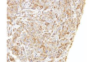 IHC-P Image Immunohistochemical analysis of paraffin-embedded A549 xenograft, using LIMCH1, antibody at 1:500 dilution. (LIMCH1 抗体  (C-Term))