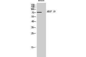 Western Blotting (WB) image for anti-A Kinase (PRKA) Anchor Protein 10 (AKAP10) (N-Term) antibody (ABIN3173722) (AKAP10 抗体  (N-Term))