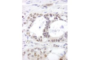 anti-DEAH (Asp-Glu-Ala-His) Box Polypeptide 15 (DHX15) (AA 350-400) antibody