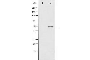 Western blot analysis of BLNK expression in etoposide treated 293 whole cell lysates,The lane on the left is treated with the antigen-specific peptide. (B-Cell Linker 抗体  (N-Term))
