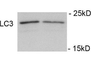 Immunoblots of SH-SY5Y cells treated with rapamycin for 1 h was probed with (ABIN389699 and ABIN2839660). (LC3C 抗体  (pSer12))