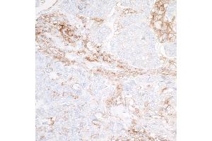 Immunohistochemistry (IHC) image for anti-Signal-Regulatory Protein alpha (SIRPA) (AA 31-368) antibody (ABIN7453985)