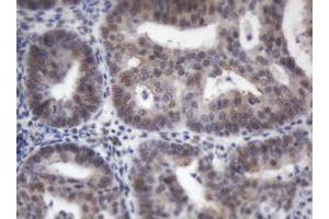 Image no. 2 for anti-Adrenocortical Dysplasia Homolog (ACD) antibody (ABIN1496406) (ACD 抗体)
