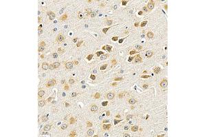Immunohistochemistry of paraffin embedded mouse brain using UTS2 (ABIN7076162) at dilution of 1:2000 (400x lens) (Urotensin 2 抗体)