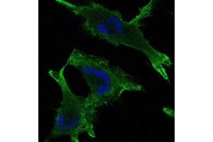Immunofluorescence analysis of U251 cells using JUP mouse mAb (green). (JUP 抗体)