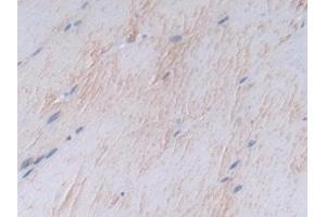 Detection of SDC1 in Rat Skeletal muscle Tissue using Polyclonal Antibody to Syndecan 1 (SDC1)