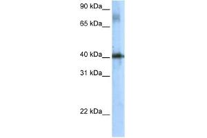 WB Suggested Anti-Tsc22d4 Antibody Titration:  5. (TSC22D4 抗体  (N-Term))