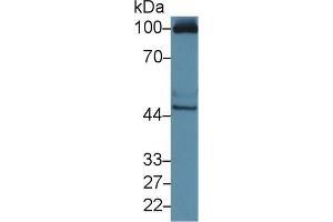 Western blot analysis of Human HepG2 cell lysate, using Mouse RAGE Antibody (3 µg/ml) and HRP-conjugated Goat Anti-Rabbit antibody ( (MOK 抗体  (AA 2-228))