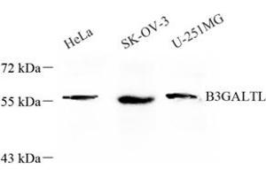 Western blot analysis of B3GALTL (ABIN7073206) at dilution of 1: 600 (B3GALTL 抗体)