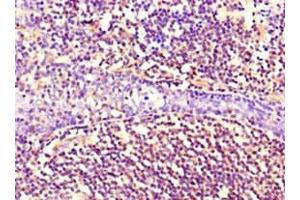 Immunohistochemistry of paraffin-embedded human tonsil tissue using ABIN7161178 at dilution of 1:100 (Nestin 抗体)
