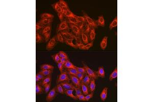 Immunofluorescence analysis of U-2 OS cells using β-Tubulin Rabbit pAb (ABIN3020552, ABIN3020553 and ABIN3020554) at dilution of 1:100 (40x lens).