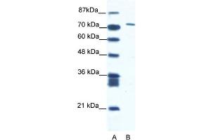 WB Suggested Anti-CXORF6 Antibody Titration:  1. (MAMLD1 抗体  (N-Term))