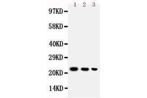 Anti-BAFF antibody, Western blotting Lane 1: Recombinant Human BAFF Protein 10ng Lane 2: Recombinant Human BAFF Protein 5ng Lane 3: Recombinant Human BAFF Protein 2. (BAFF 抗体  (C-Term))