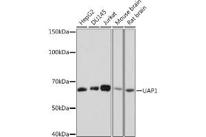 Western blot analysis of extracts of various cell lines, using U Rabbit mAb (ABIN7271211) at 1:1000 dilution. (UAP1 抗体)