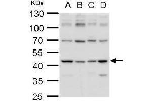 Western Blotting (WB) image for anti-Isocitrate Dehydrogenase 1 (NADP+), Soluble (IDH1) (Center) antibody (ABIN2856056)