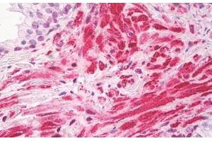 Image no. 2 for anti-Zinc Finger, CCHC Domain Containing 11 (ZCCHC11) (AA 1403-1452) antibody (ABIN6749768) (ZCCHC11 抗体  (AA 1403-1452))