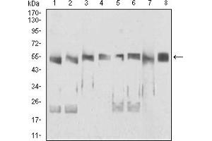Western Blotting (WB) image for anti-DEAD (Asp-Glu-Ala-Asp) Box Polypeptide 39B (DDX39B) (AA 1-250) antibody (ABIN5926983)