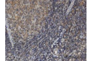 Immunoperoxidase of monoclonal antibody to EDC4 on formalin-fixed paraffin-embedded human tonsil. (EDC4 抗体  (AA 1302-1401))