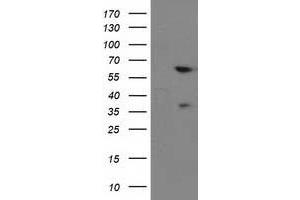 HEK293T cells were transfected with the pCMV6-ENTRY control (Left lane) or pCMV6-ENTRY BAIAP2 (Right lane) cDNA for 48 hrs and lysed. (BAIAP2 抗体)