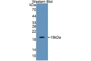 Western blot analysis of the recombinant protein. (INPP4A 抗体  (AA 1-137))