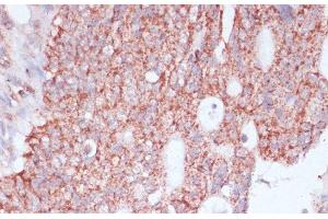 Immunohistochemistry (Paraffin-embedded Sections) (IHC (p)) image for anti-Ribosomal Protein L30 (RPL30) antibody (ABIN7257307)