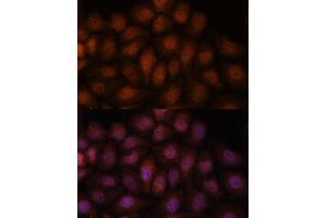 Immunofluorescence analysis of HeLa cells using IPO8 antibody (ABIN7267859) at dilution of 1:100. (Importin 8 抗体  (AA 878-1037))
