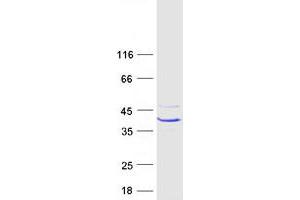 Western Blotting (WB) image for Carbonic Anhydrase VII (CA7) (Transcript Variant 2) protein (Myc-DYKDDDDK Tag) (ABIN2713135)
