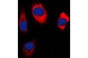 Immunofluorescent analysis of EDG5 staining in Hela cells. (S1PR2 抗体  (C-Term))