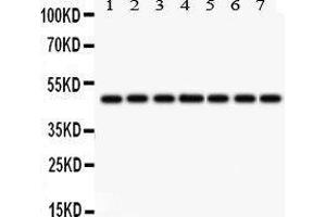 Western Blotting (WB) image for anti-Isocitrate Dehydrogenase 1 (NADP+), Soluble (IDH1) (AA 381-413), (C-Term) antibody (ABIN3043855) (IDH1 抗体  (C-Term))