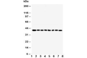 Western blot testing of PPID antibody and Lane 1:  rat brain (PPID 抗体  (AA 351-370))
