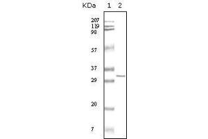 Western blot analysis using HPTR mouse mAb against truncated HPRT recombinant protein. (HPRT1 抗体)