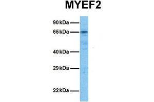 Western Blotting (WB) image for anti-Myelin Expression Factor 2 (MYEF2) (Middle Region) antibody (ABIN2777558)