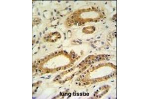 DDO Antibody (Center) (ABIN650991 and ABIN2840026) IHC analysis in formalin fixed and paraffin embedded lung tissue followed by peroxidase conjugation of the secondary antibody and DAB staining. (DDO 抗体  (AA 102-130))