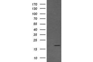 Image no. 1 for anti-Cancer/testis Antigen 1B (CTAG1B) antibody (ABIN1499907) (CTAG1B 抗体)