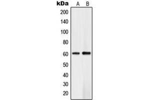 Western blot analysis of PLK5 expression in Jurkat (A), human brain (B) whole cell lysates. (PLK5 抗体  (Center))