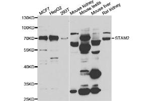 Western blot analysis of extracts of various cell lines, using STAM2 antibody (ABIN5974246) at 1/1000 dilution. (STAM2 抗体)