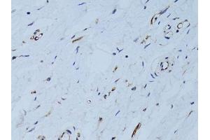 Immunohistochemistry of paraffin-embedded human breast using SELE Antibody. (Selectin E/CD62e 抗体  (AA 22-230))