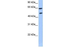 Transfected 293T; WB Suggested Anti-ZNF449 Antibody Titration: 0.