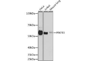 Western blot analysis of extracts of various cell lines, using PFKFB3 Rabbit mAb (ABIN1680620, ABIN3018306, ABIN3018307 and ABIN7101590) at 1:500 dilution. (PFKFB3 抗体)
