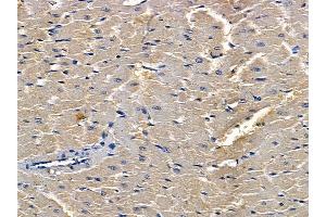 ABIN6262614 and ABIN6268926 at 1/100 staining rat heart tissue by IHC-P.