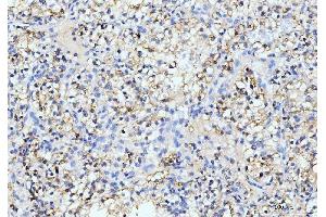 IHC analysis of ITCH/AIP4 using anti-ITCH/AIP4 antibody (ABIN7600263).